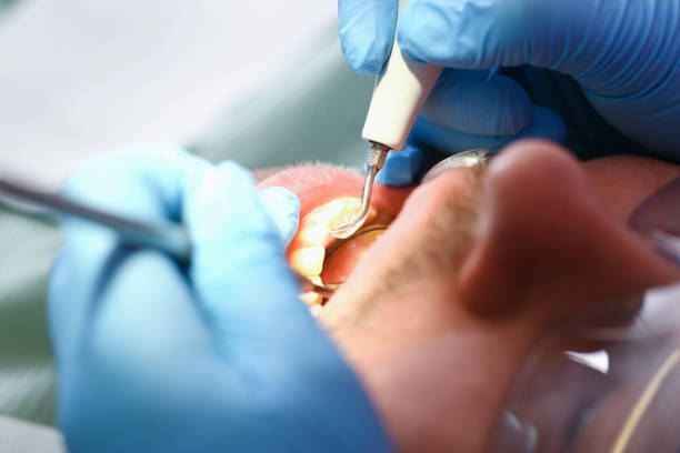 Best Emergency Treatment for Toothache in Strongsville, OH