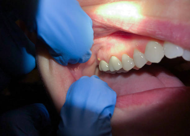 Best Pediatric Emergency Dentist in Strongsville, OH