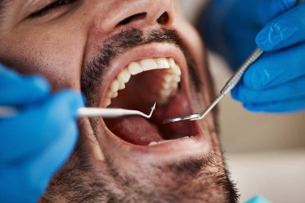 Best Emergency Treatment for Toothache in Strongsville, OH